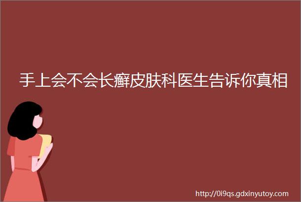 手上会不会长癣皮肤科医生告诉你真相